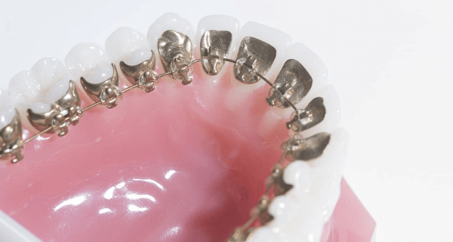 Консультация ортодонта
